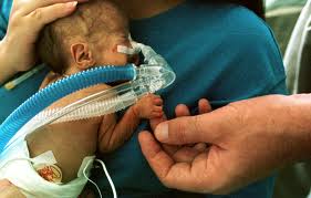 premature_infant_with_breathing_tube.jpg